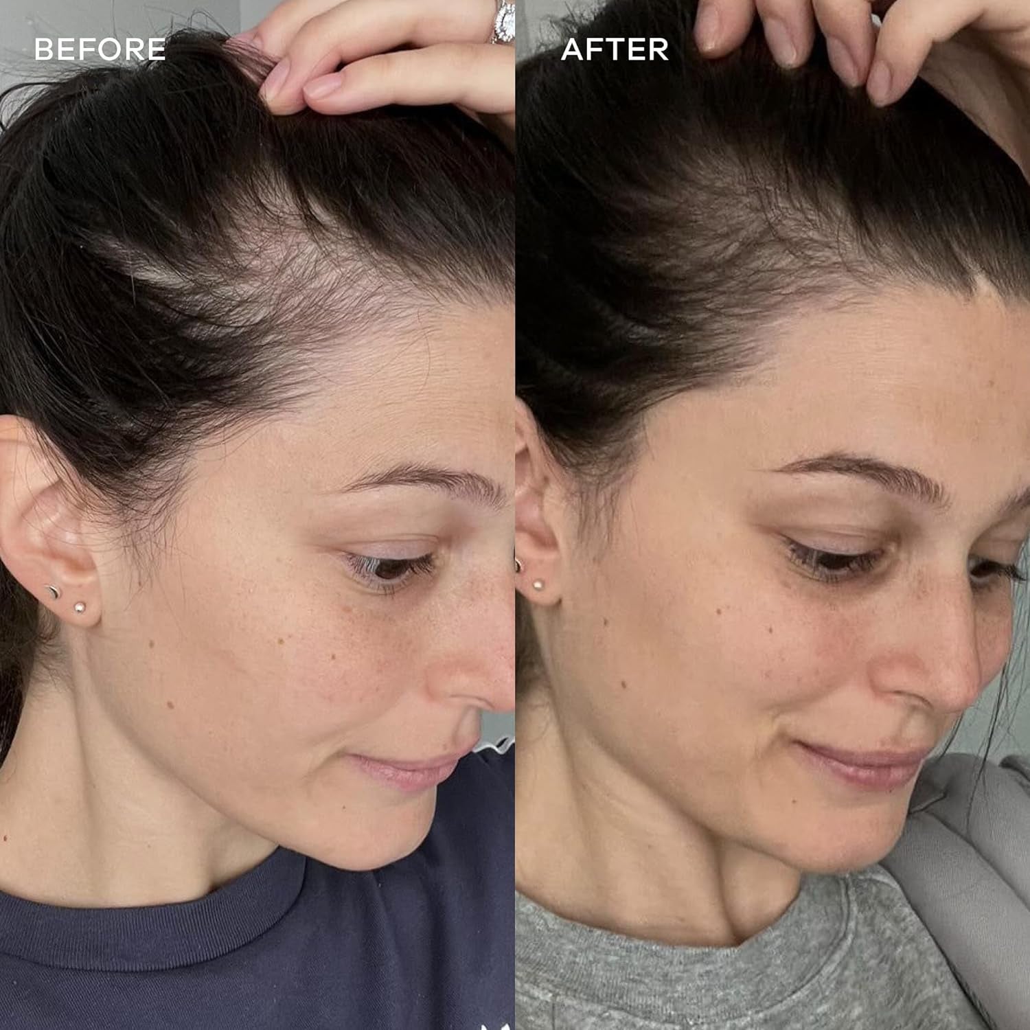 - Natural Hydrolysed Marine Collagen Sachets | Promotes Glowing Skin + Smothes Fine Lines (Original, 14 Sachets)